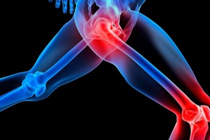 joint-pain