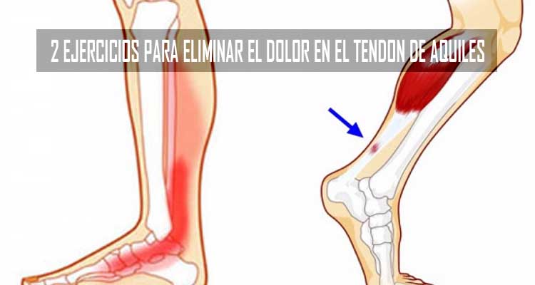 DOLOR EN EL TENDON DE AQUILES