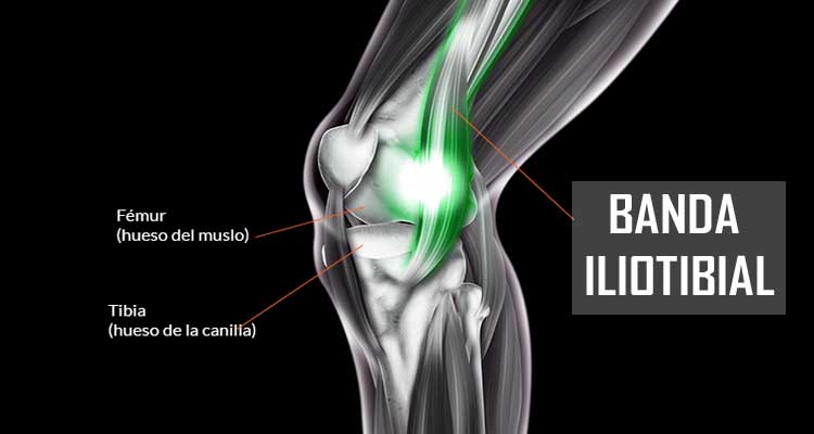 LA CINTILLA ILIOTIBIAL