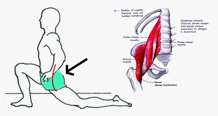 PSOAS