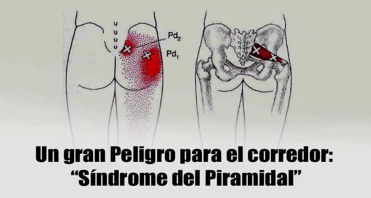 Síndrome del Piramidal