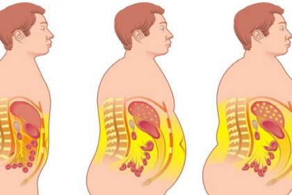 grasa abdominal