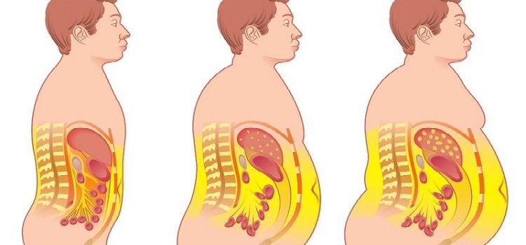 perder grasa abdominal