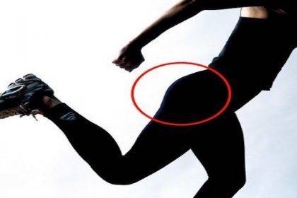 GLUTEOS