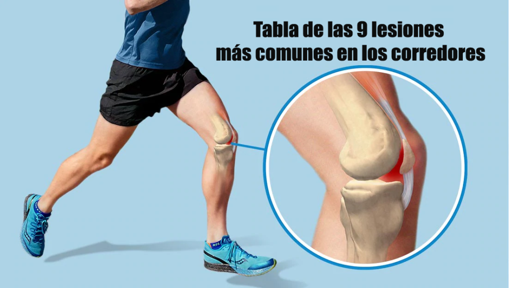 Tabla de las 9 lesiones más comunes en los corredores